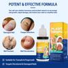Plant Nail Care Solution 10ml Foot Care And Maintenance Nail Polish Nail Care Solution 10ml