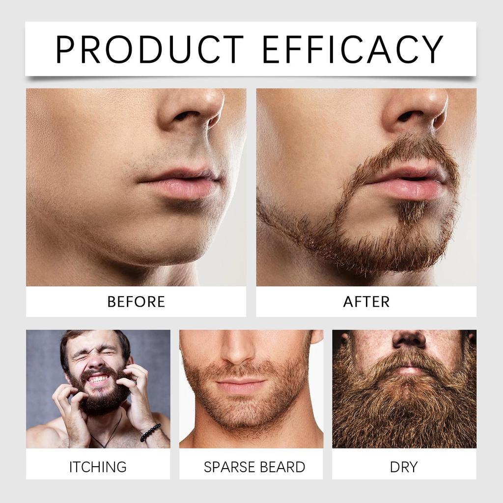 Nourishing Beard Set – Oil + Roller. Tames, softens, and moisturizes beard hair for a stronger, healthier look.