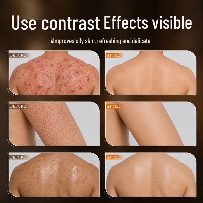 Dr. Rafiq Sulfur Anti-Acne and Anti-Mite Body Wash