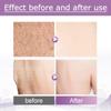 56,7 г First Aid Beauty Bump Eraser Скраб для тела отшелушивающий от кератоза Pilaris Подходит для различных типов кожи