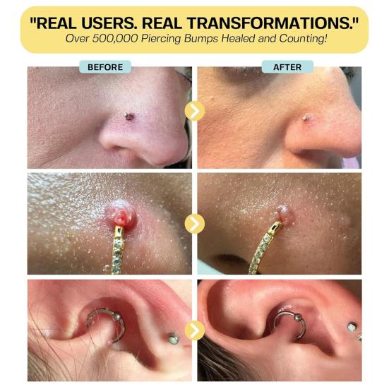 Soothing Piercing Aftercare Oil Keloid Bump Treatment with Jojoba And Tea Tree Oil Scar Reduction Healing Oil for Ear Nose Belly Button Piercings