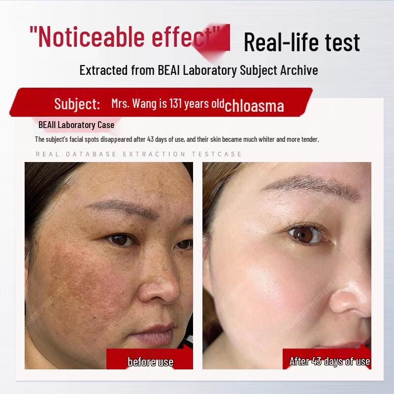 Сыворотка с ниацинамидом для отбеливания и осветления пигментных пятен