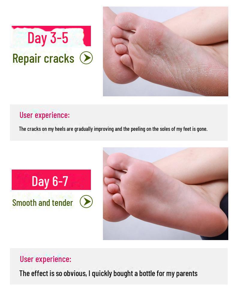 Horse Oil Foot & Hand Cream 250ml - For Cracked Heels, Peeling Skin, Anti-Cracking.