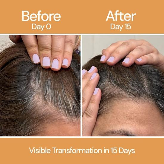 Сыворотка для роста волос CITTA | Стимулирует рост волос, активирует фолликулы и предотвращает истончение | Биотин, масло розмарина и пажитника | 50 мл