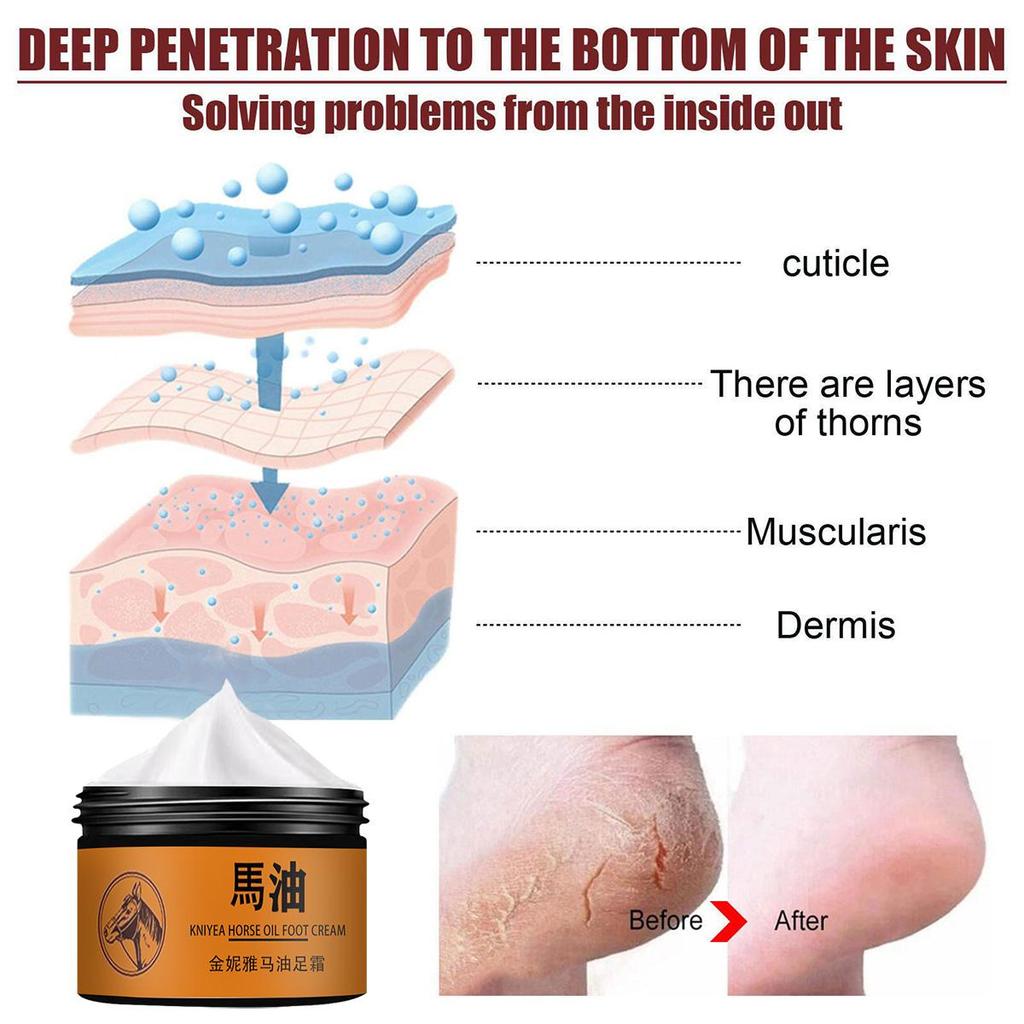 Крем для ног Крем для заживления трещин на пятках Устранение омертвевшей кожи Уход за руками и ногами Увлажняющий крем