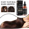 Youdaoplaceholder0 Hair Care Essence Gently Nourishes The Scalp, Massages And Cares For Smooth Hair, Moisturizes And Cares For Essential Oil