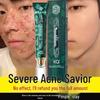 Nanjing Tongrentang Acne & Blemish Repair Cream