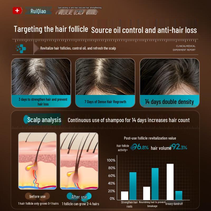 FIVERAMS Anti-Hair Loss Shampoo with Ginger & Arborvitae Leaf, 500ml