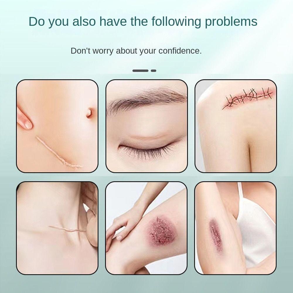 Самоклеящаяся лента для лечения рубцов, многоразовые пластыри для ухода за рубцами, для покрытия пятен на теле и шрамов