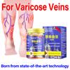 Varicose Veins Special Plaster Stick Lower Limb Veins Bulge Old Rotten Legs Cold Compress Gel