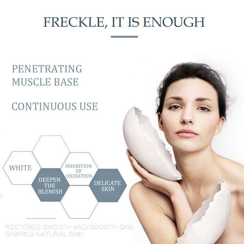 Крем против пятен, питающий кожу, увлажняющий, лифтинг, укрепляющая косметика, удаление веснушек, прыщей, пигмента, меланина, крем для лица
