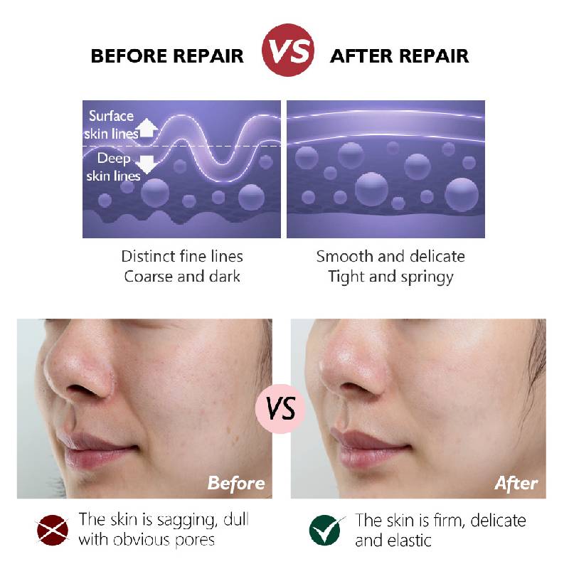 Ретинол Сыворотка для лица Гиалуроновая кислота Увлажняющая Против морщин Антивозрастная Отбеливающая Сыворотка для ухода за кожей