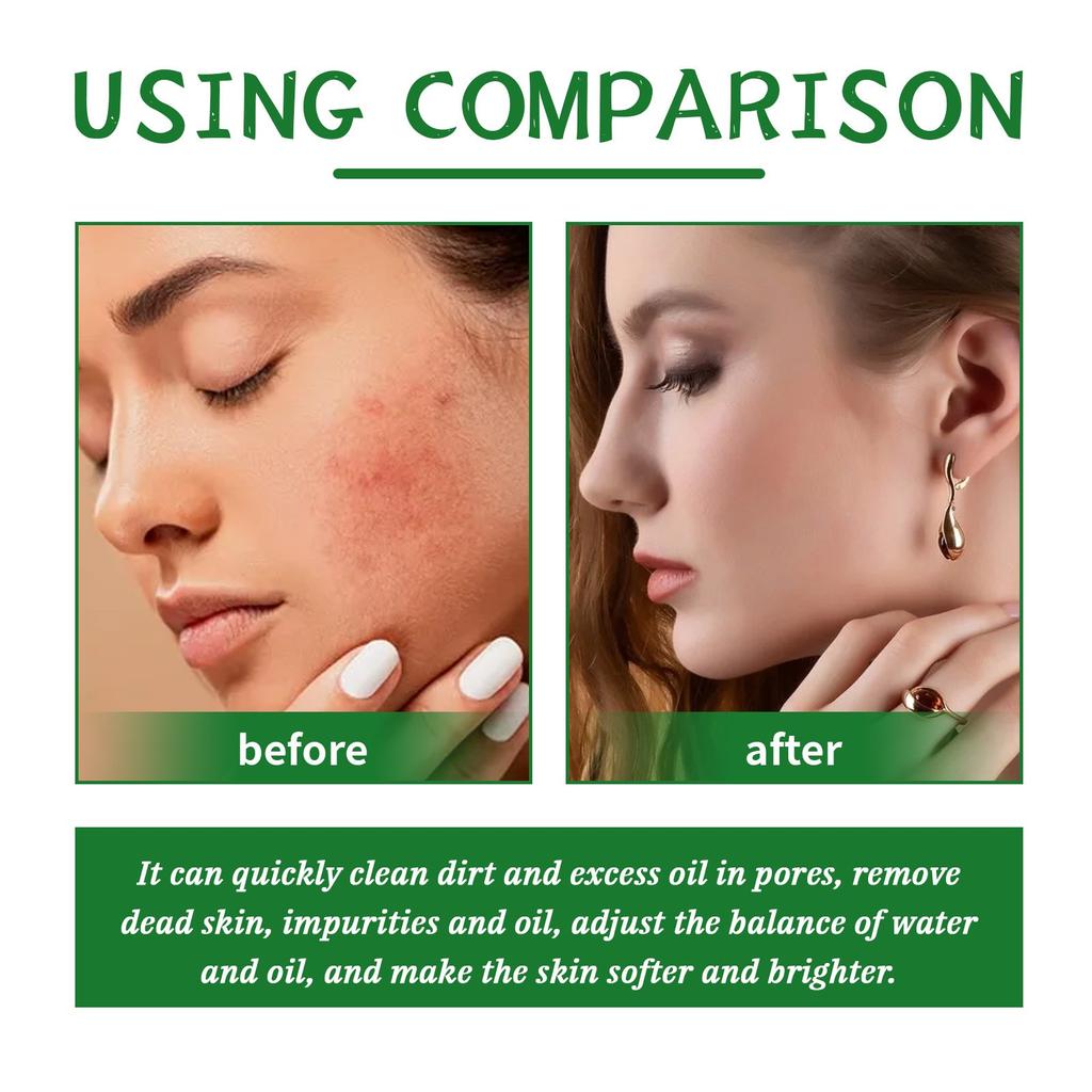 Натуральный скраб для лица, отшелушивающий скраб, скраб для тела, глубокое очищение, осветление акне, увлажнение и омоложение