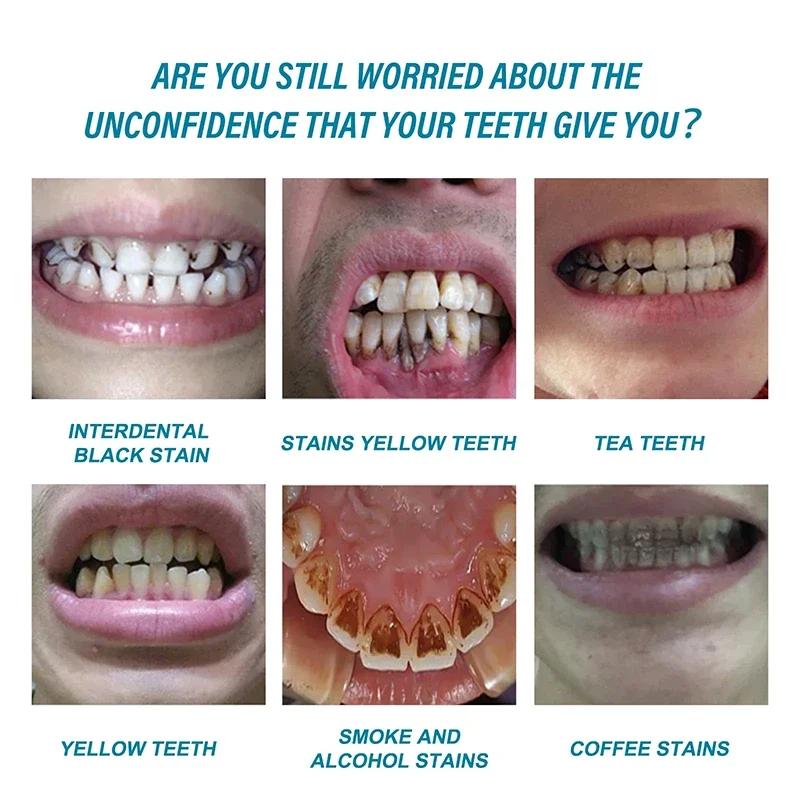 Быстрое удаление пятен Зубная паста Удаление налета Пятна Гигиена полости рта Чистка Свежее дыхание Отбеливание зубов Инструменты Уход за здоровьем полости рта