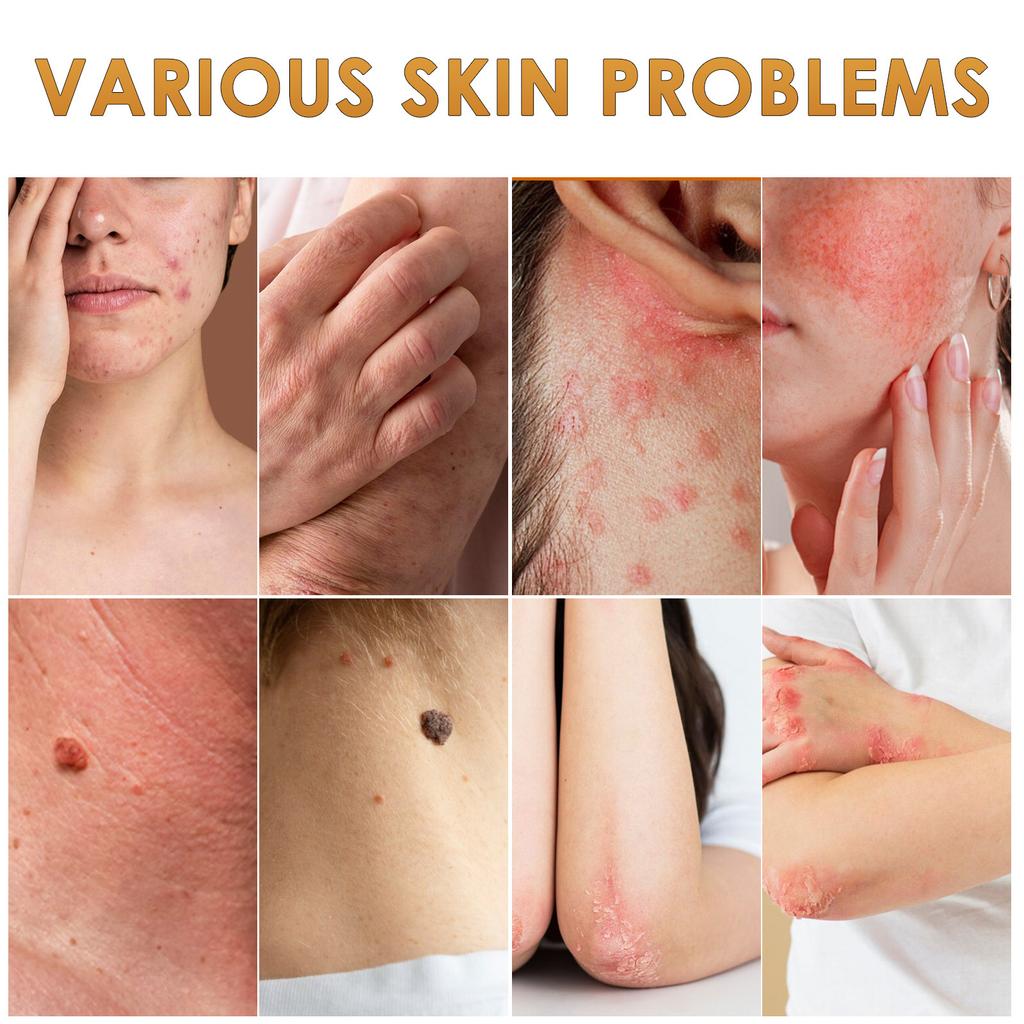 Крем для кожи Питательный крем для ухода за кожей Этикетки для кожи и улучшает дефекты. Подходит для всех типов кожи