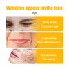 Collagen Smile Line Wrinkle Patches Facial Wrinkle Patches - Anti-wrinkle Facial Patches For Smoothing Smile Lines