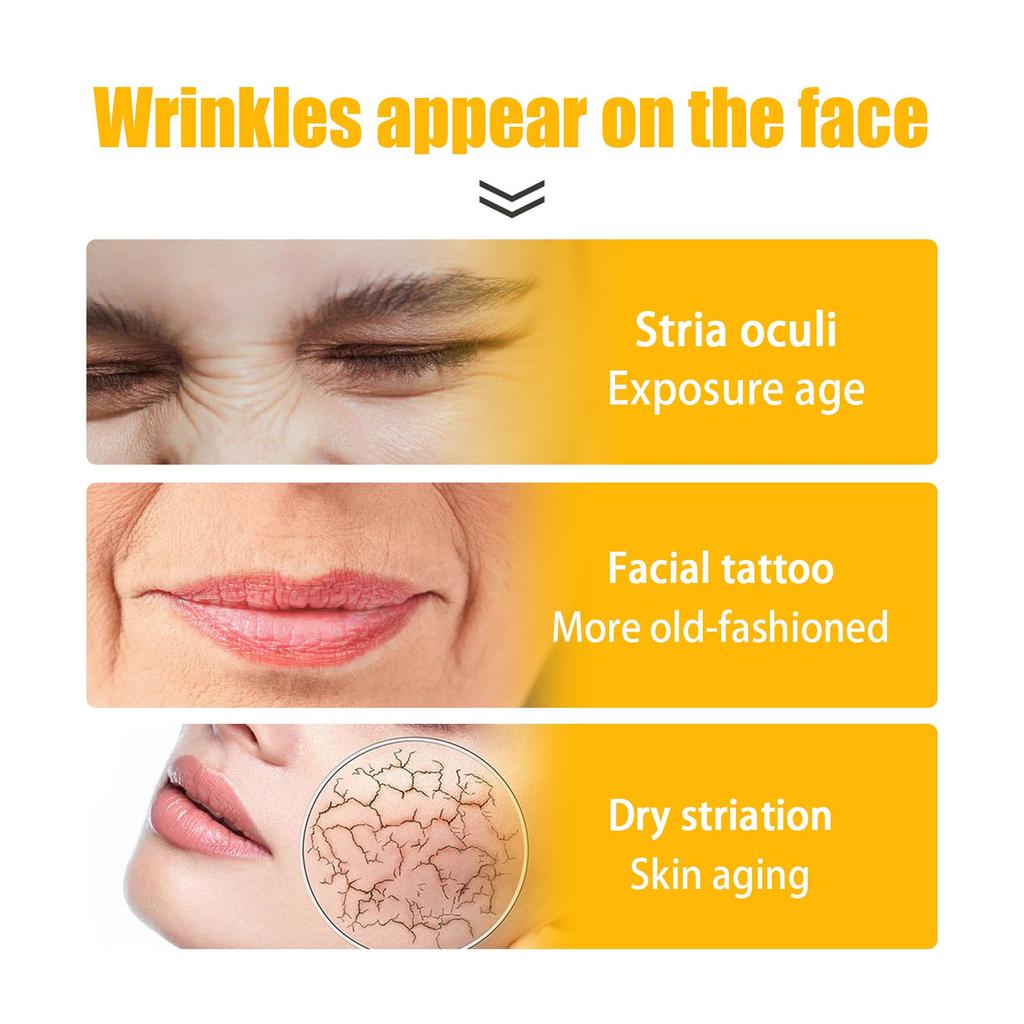 Collagen Smile Line Wrinkle Patches Facial Wrinkle Patches - Anti-wrinkle Facial Patches For Smoothing Smile Lines
