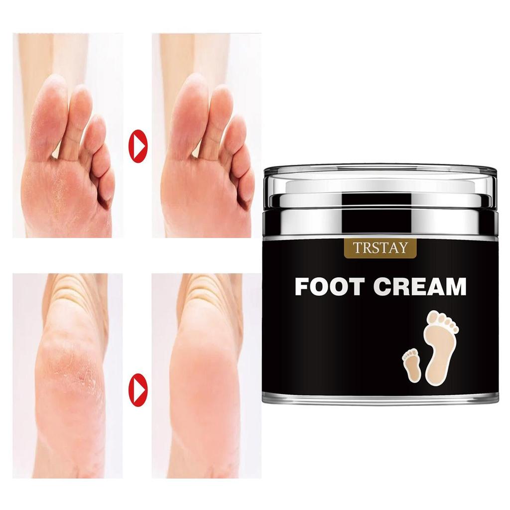 Heel Dry Crack Anti Wrinkle Softening Cream Tightens, Fades, Repairs Fine Lines On Hands and Feet, Eliminates Dead Skin, and Rejuvenates Cracks