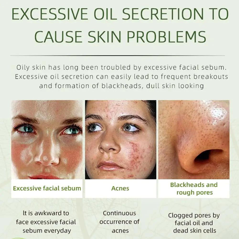 Крем для лица от прыщей, устранение больших пор, лечение прыщей, контроль жирности, сужение пор, крем для лица, уход за кожей, красота, здоровье