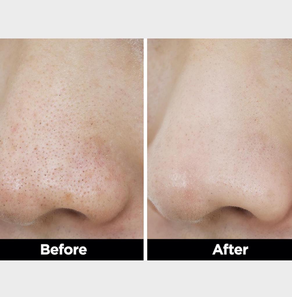 Очищающее масло для лица