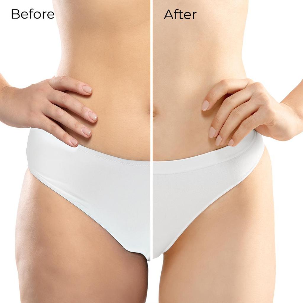 Guasha Massage Set with Birdie Massager and Himenia Anti-Cellulite Complex