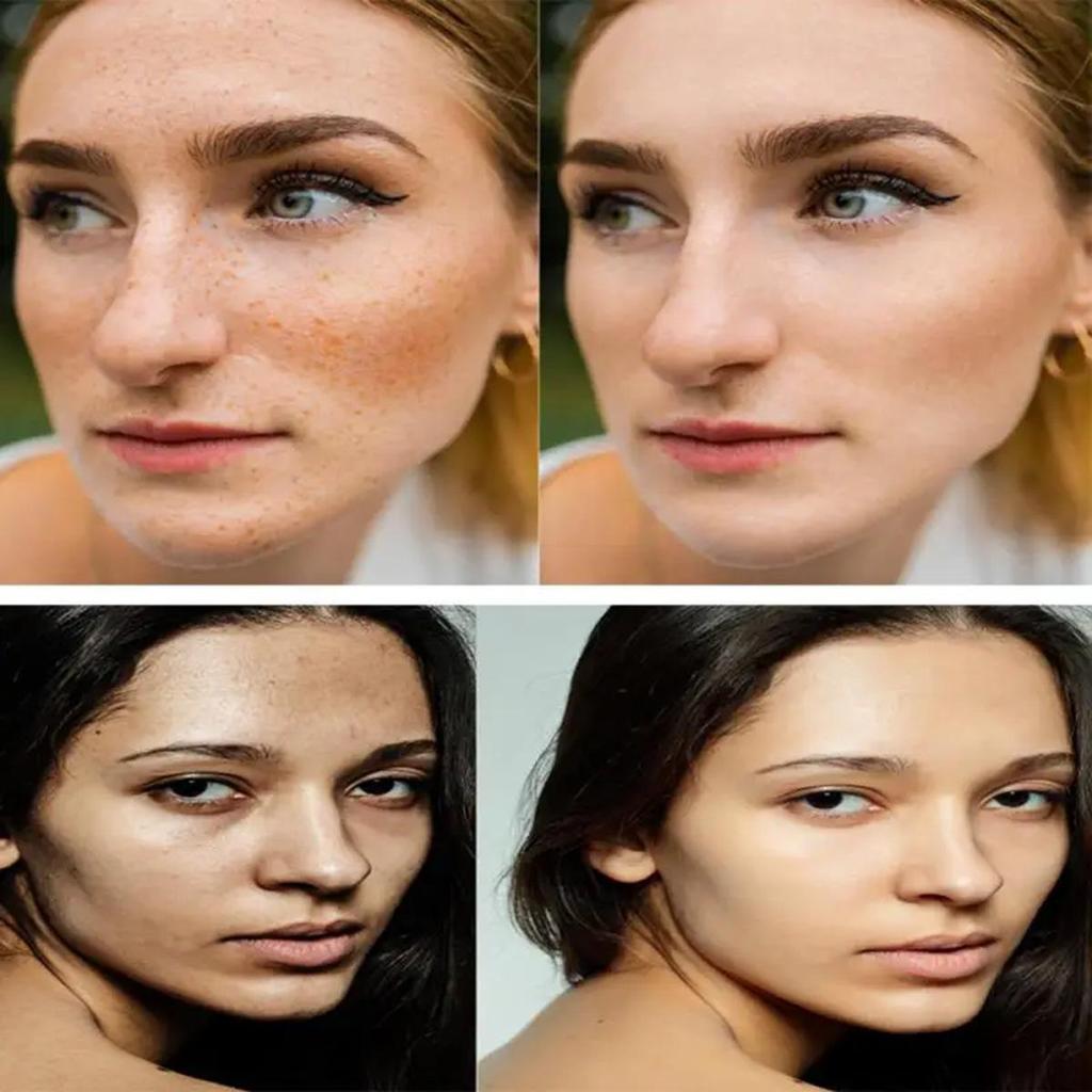 Крем против старения, богат коллагеном, предотвращает появление сухих линий, увлажняет и смягчает, эффективный отбеливающий и удаляющий веснушки крем