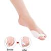Dr.Pedi Gel Toe Bunion Corrector Separators Hallux Valgus Pro Toe Stretchers Bunion Straightener Alignment (1 Pair): Beauty