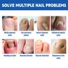 10Pcs Nail Correction Stickers Ingrown Toenail Onychomycosis Repair Patch Paronychia Treatment Recover Corrector Pedicure Tools