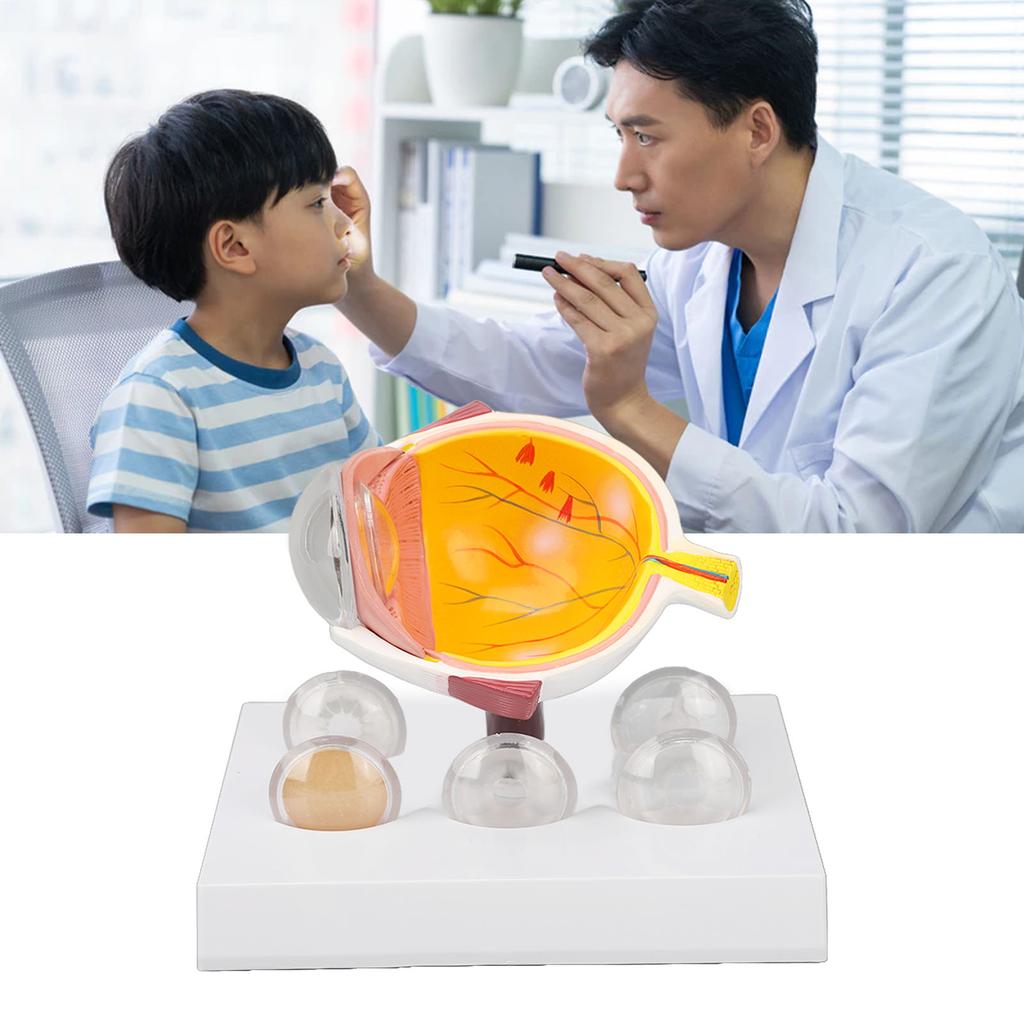 Eyeball Lesion Model Enlarged Human Eye Anatomical Model Accurate Shows Optic  Cornea  Lens  Eyeball Model