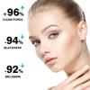 Remove Nasal Strips Pore Strip Clear Black Head 3-шаговый набор для чистки прыщей, сужения пор и удаления черных точек с помощью ложки +40 полосок 30 г