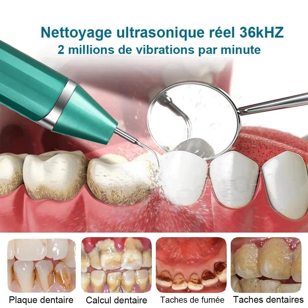 Стоматологический скалер, ультразвуковой скалер, очиститель зубов, удаление зубного камня, электрический звуковой прибор для удаления налета с зубов, пятен, зубного камня