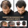 (2pcs)Ri - Root Activator Shampoo, Mane Root Activator Shampoo, Shampoo Root Activator Promotes Hair Growth For Men Hair Thickening Shampoo