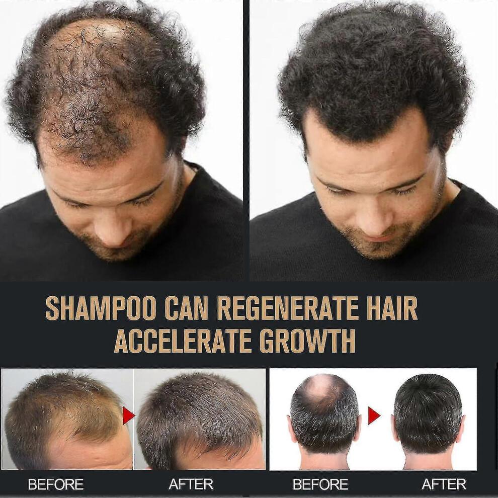 (2pcs)Ri - Root Activator Shampoo, Mane Root Activator Shampoo, Shampoo Root Activator Promotes Hair Growth For Men Hair Thickening Shampoo