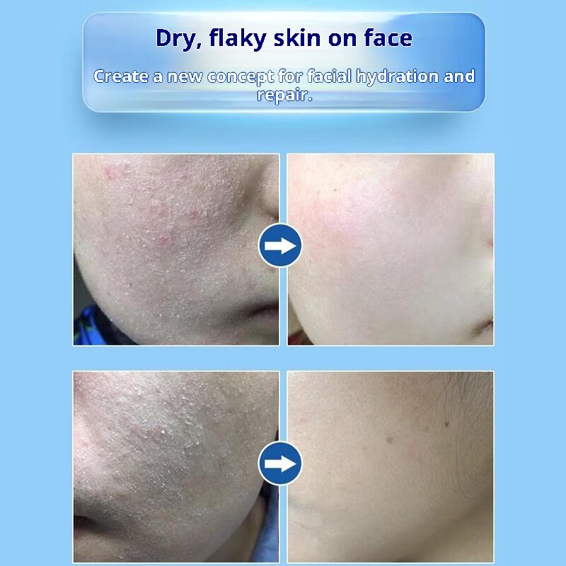 Крем для здоровья Zhuge Taiyi Keikang, красные прыщи на внутренней стороне бедер, паховая эпидермофития, зуд мошонки, грибковая инфекция