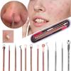 Salon Deep Cleaner Blackhead Tweezers Acne Needle 4x Blackhead Remover Tool Kit Pimple Remover