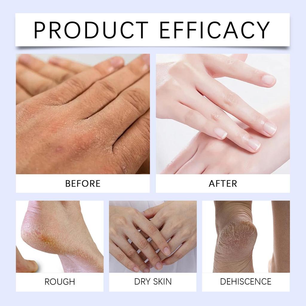 XIMONTH Крем для рук и ног 50 г, Натуральная формула, Смягчает мозоли, Увлажняет и питает руки и ноги