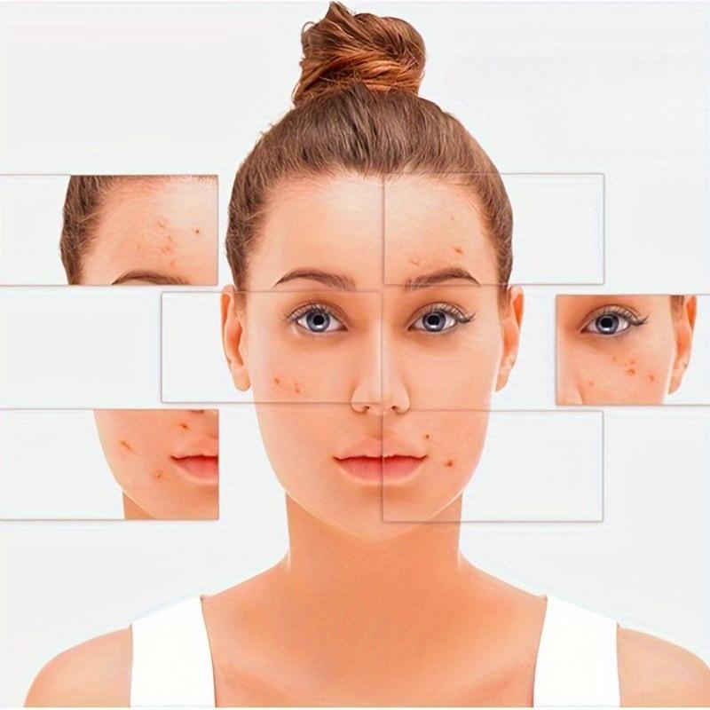 Набор игл для удаления угрей, инструмент для удаления черных точек, набор для удаления угрей, инструмент для удаления угрей на носу и лице с коробкой для устранения пятен