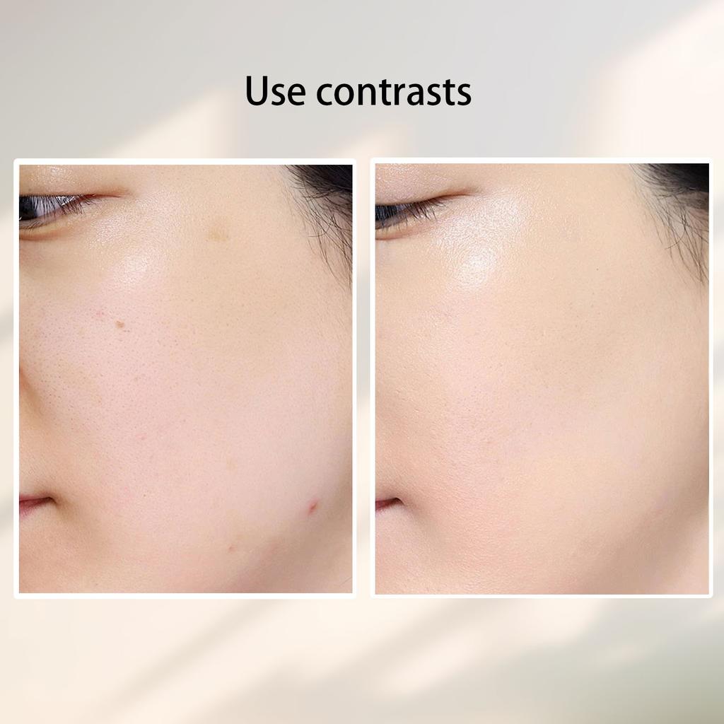 36 Acne Patch Концентрированный корректор от прыщей (инкапсулированный)