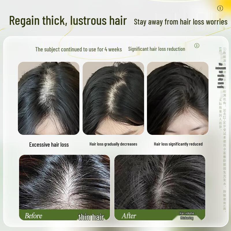 Zhuo Lan Ya Ginger Anti-Hair Loss Shampoo