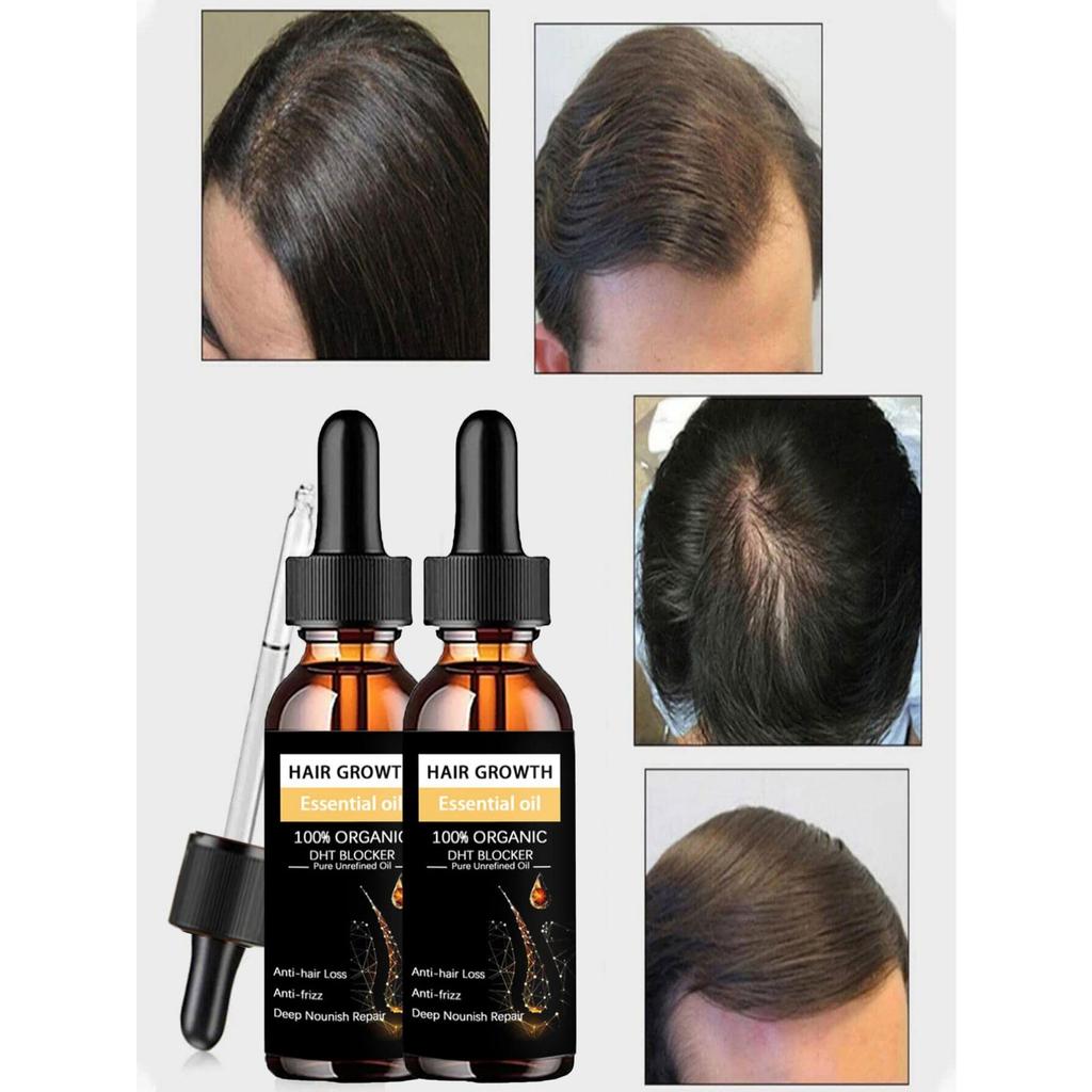 Черное касторовое масло Питает рост волос Массаж кожи Эфирное масло Рост бровей Предотвращает старение кожи Средства по уходу за волосами