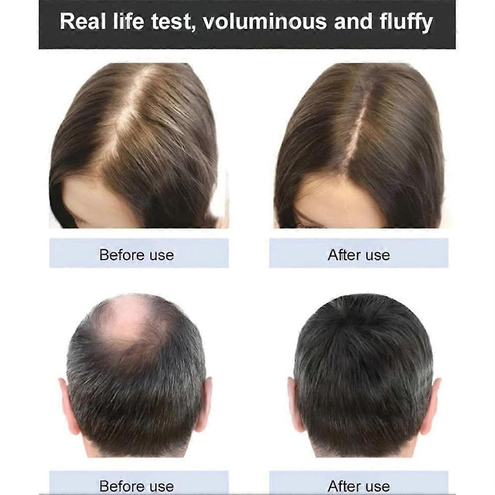 200ML Anti-Hair Loss Hair Ginger Shampoo, Nourishing Repairing Hair Shampoo, for Long/Short Hair