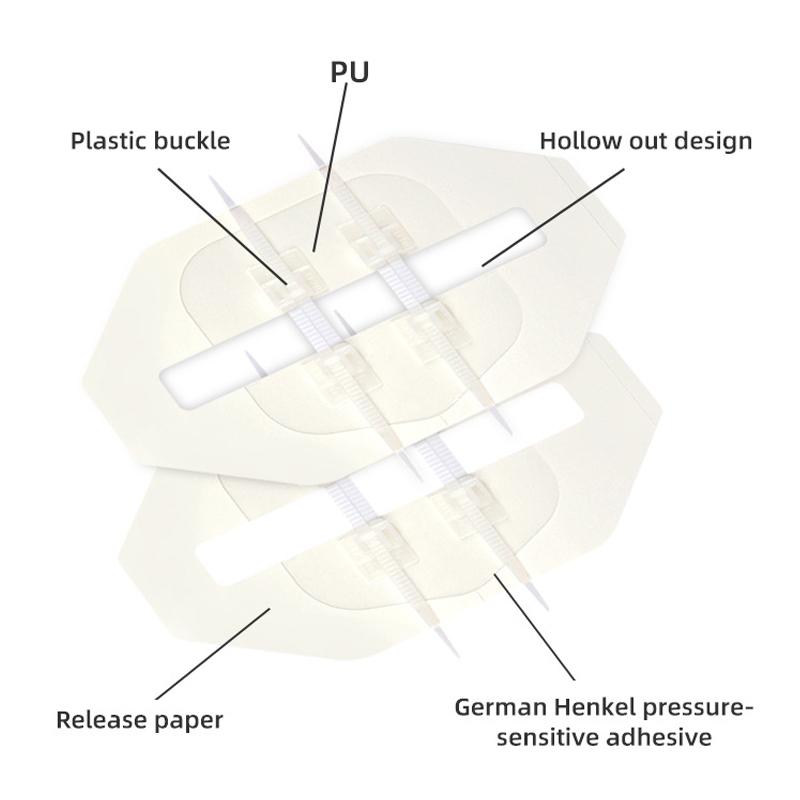 Emergency Wound Closure Zip Stitch Sutures Bandaids Repair Wounds Without Stitches For Outdoor Activities Quick Clot Wound