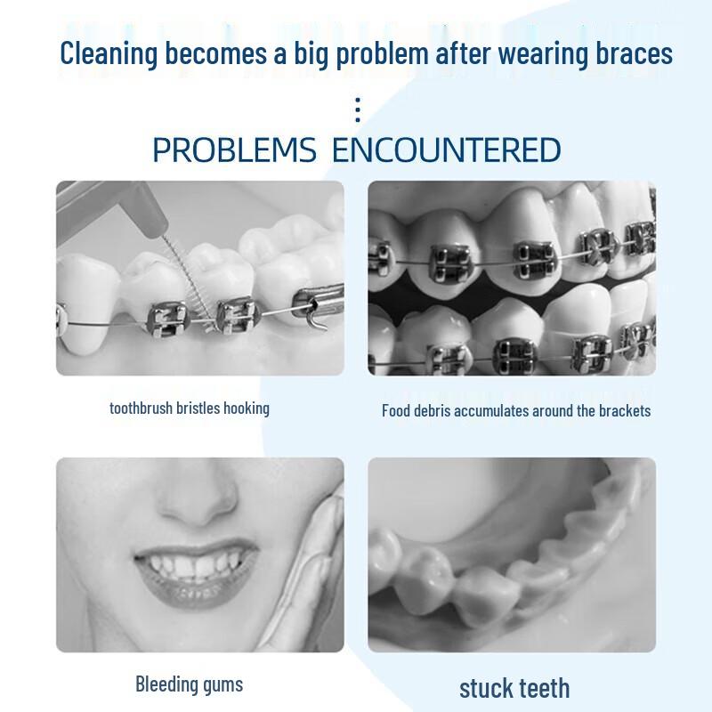 FAWNMUM Orthodontic Dental Care 50-Pack