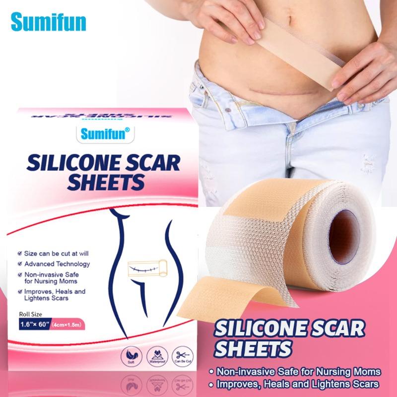 150 см силиконовый гелевый пластырь от шрама, рулонный пластырь от шрама, небольшой самоклеящийся пластырь от шрама, невидимый пластырь для кесарева сечения