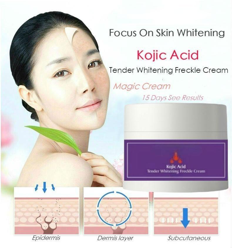 Отбеливающий крем для лица с койевой кислотой, корректор темных пятен от мелазмы и прыщей