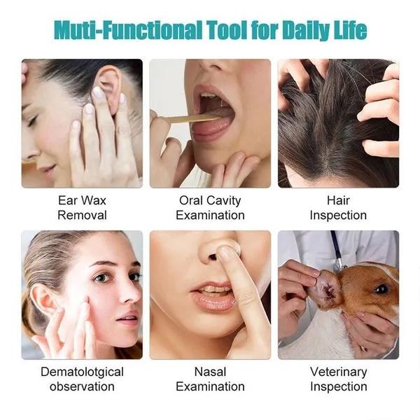Очиститель ушей Высокоточный инструмент для удаления ушной серы со светодиодной подсветкой камеры Беспроводной отоскоп Умный набор для чистки ушей-1 комплект