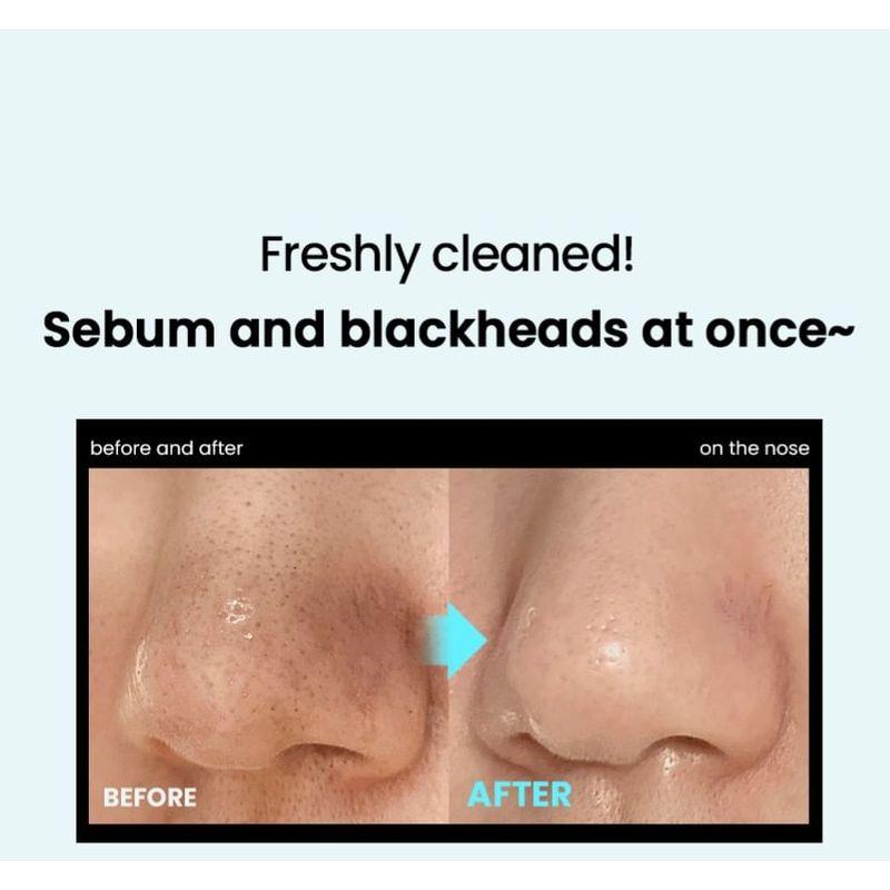 ilso Специальный набор Super Melting Sebum Softener