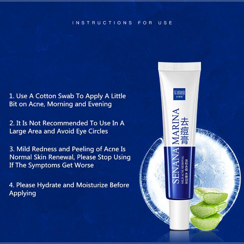 SENANA Крем от прыщей, увлажняющий, контроль жирности, исчезновение следов прыщей, легкий, не раздражающий.