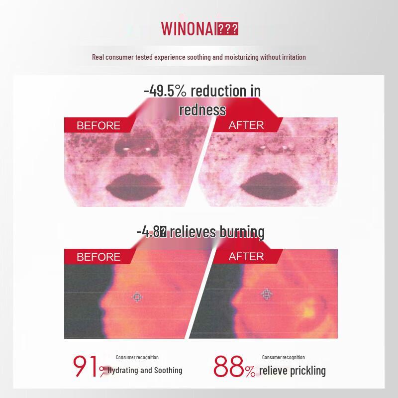 WINONA Soothing Moisturizing Silky Facial Mask (6-Pack)