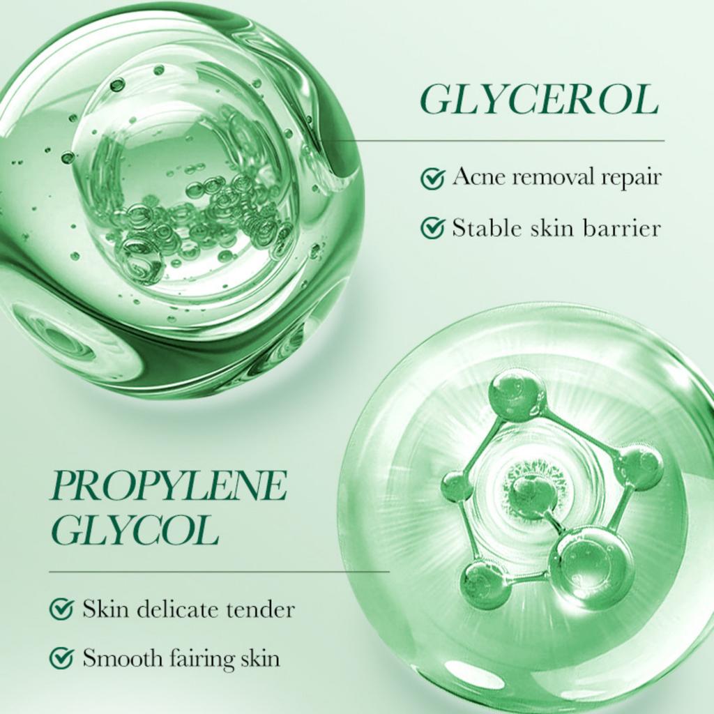 Салициловая сыворотка от прыщей Student Acne Serum Personal Skin Care, увлажняющая сыворотка 30 мл